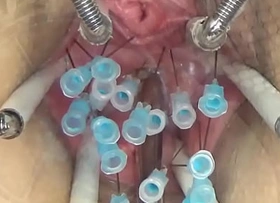 Extreme German BDSM Needles inner Pussy Cervix enhanced by Interior